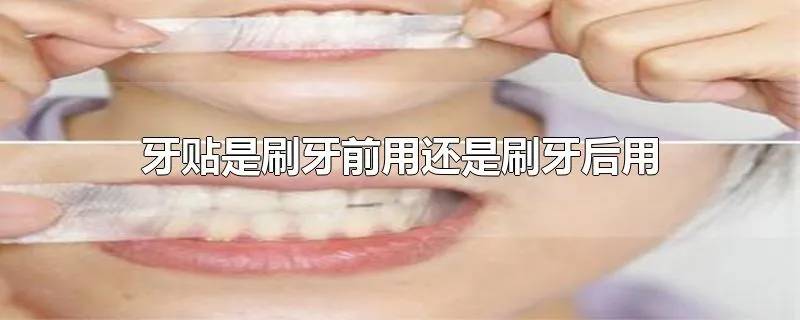 牙贴是刷牙前用还是刷牙后用