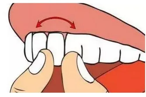 牙齿松动应该怎么办呢 牙齿为什么会松动呢