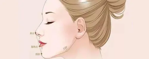 下颌线在哪