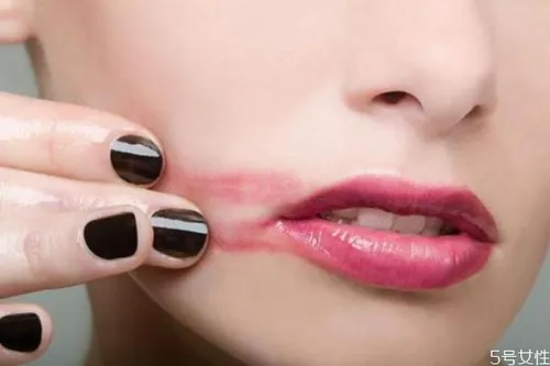 擦口红导致嘴唇干裂脱皮怎么办 唇部保养的方法