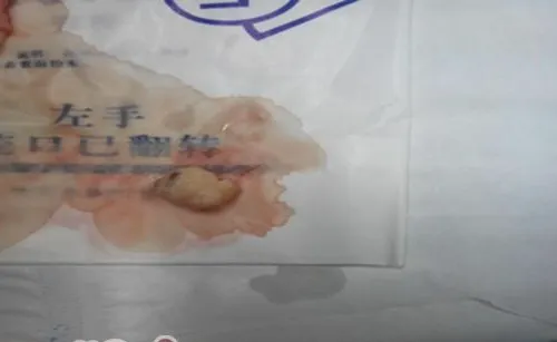 一例犬子宫蓄脓和卵巢囊肿的诊治