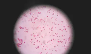 猫感染性腹泻及诊疗