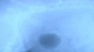 犬尿道结石的诊断