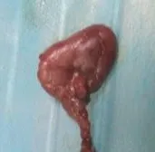 狗狗唾液腺囊肿切除案例