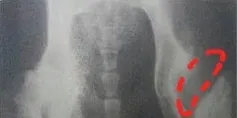 浅谈犬的髋关节发育异常的治疗