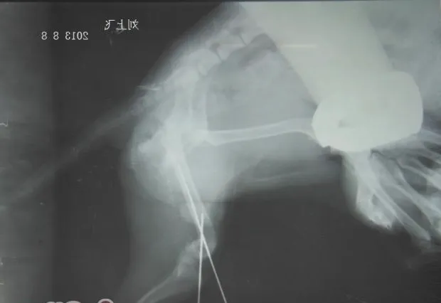 一例犬股骨远端骨折案例分析