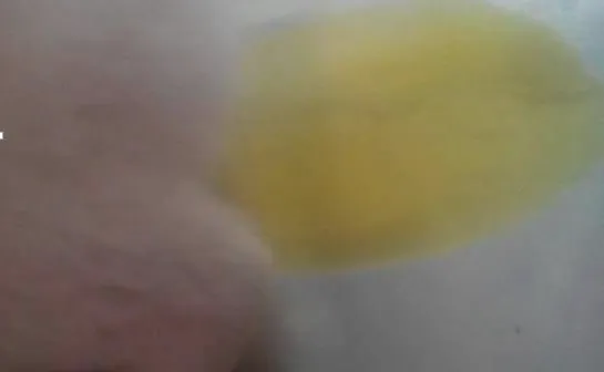 一例猫咪黄疸的疾病诊疗体会