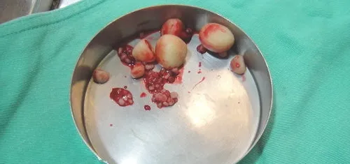 犬尿道结石的诊断