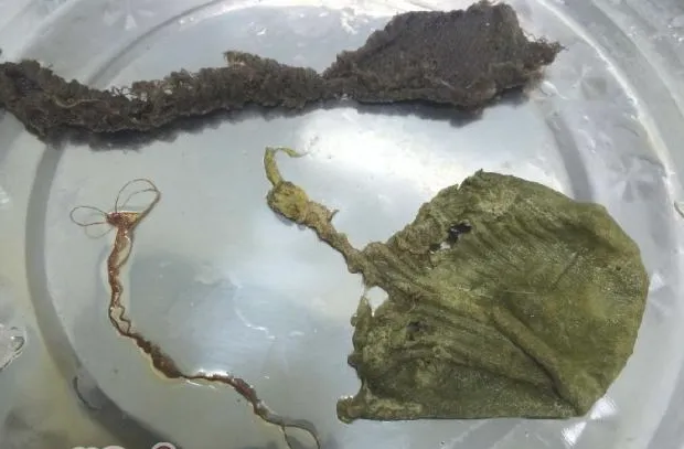 犬异物性肠道阻塞的治疗