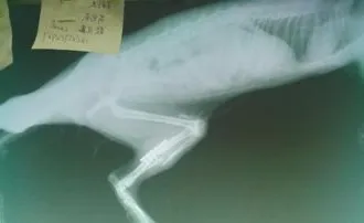 一例关于骨折后治疗延误的案例