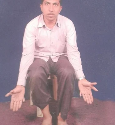 世界之最：印度男子有28根手指脚趾(印度有什么是世界之最)