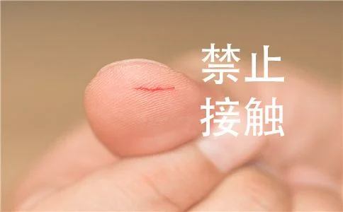 3、不要频繁用手去触碰伤口