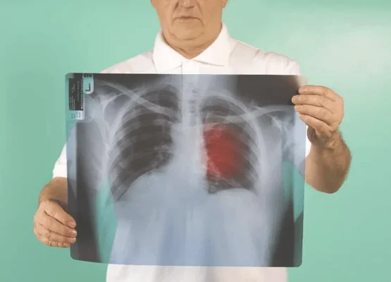 肺部变白是什么病引起的？肺脏变白可能是这