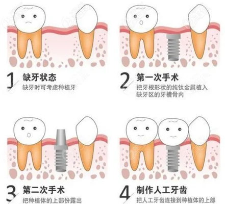 农村院子怎么种植花卉（一个月不管照样有花赏）