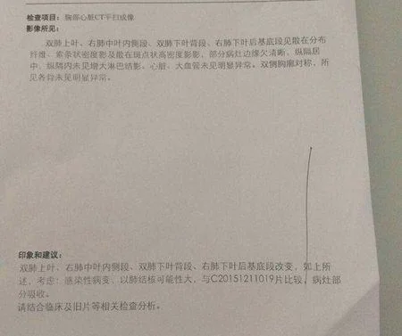 得了肺结核却意外怀孕了怎么办(肺结核治