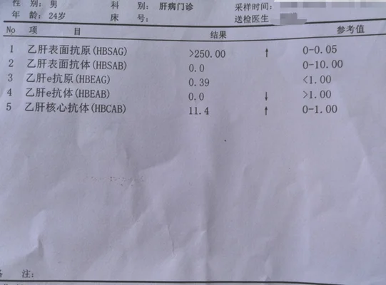 乙肝五项定量参考值范围是多少(若乙肝五