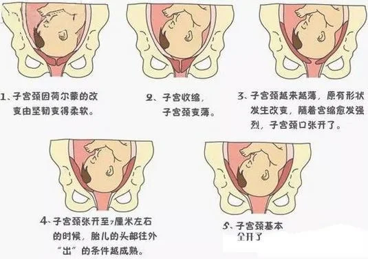 孕妇入盆是什么感觉