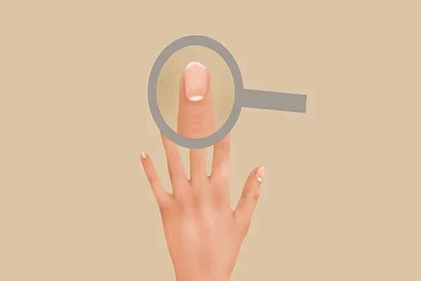 指甲有竖纹是身体的什么信号(指甲有竖纹是身体的什么信号怎么办)