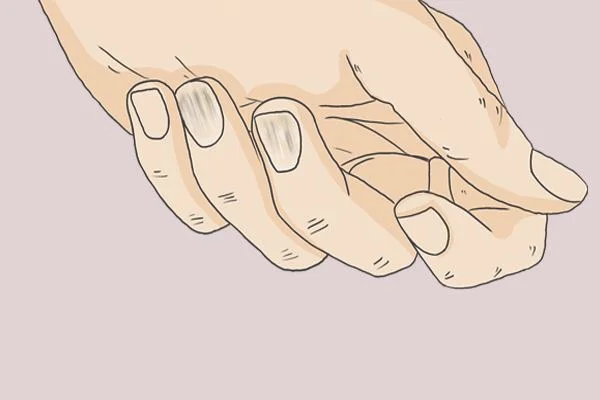 指甲有竖纹是身体的什么信号(指甲有竖纹