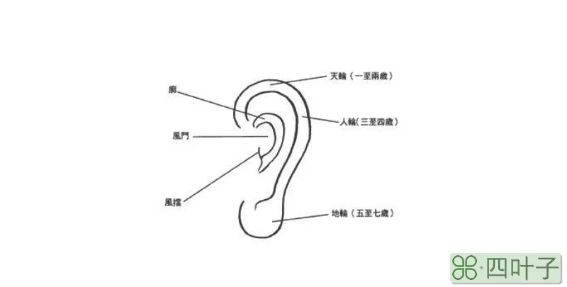 耳洞打歪了怎么办