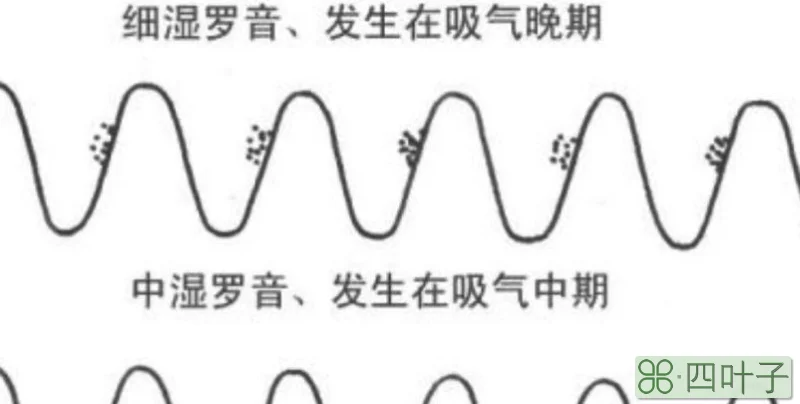 干啰音与湿啰音的区别