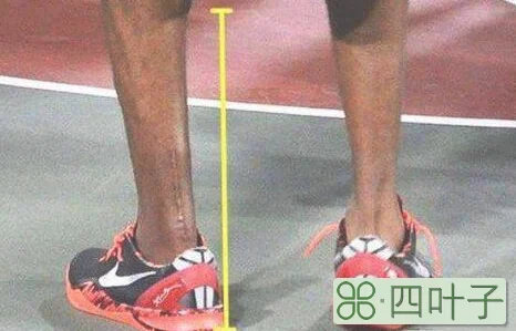 跟腱短的表现