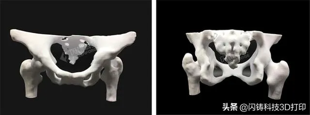 3D打印到底是什么？我们来告诉你