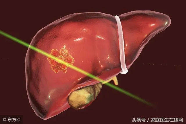 保护肝脏，做出这3个“行动”，比吃什么保肝药强