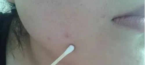 软膏
